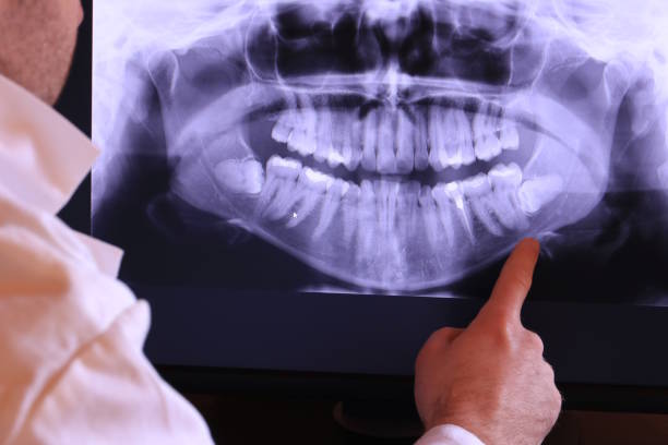 Best Cracked Tooth Emergency Dentist  in Toast, NC